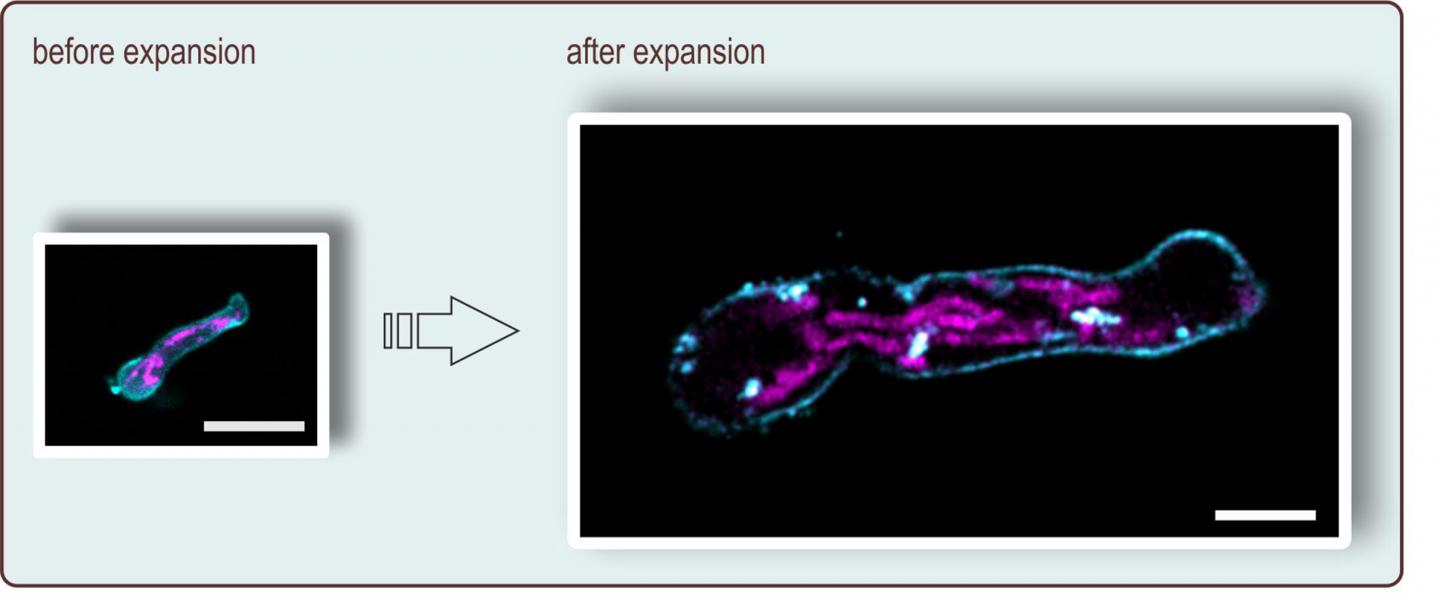 Expansion Microscopy of a Fungal Cell