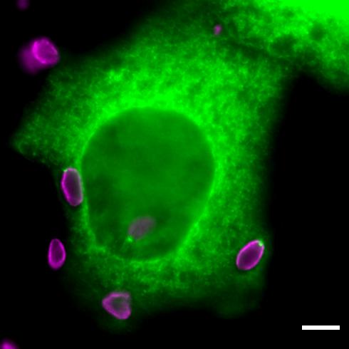 Toxoplasma gondii parasite