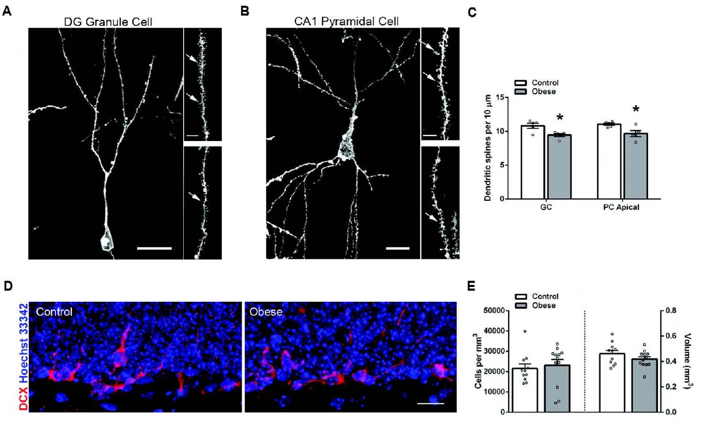 Microglia, Synapses, and Obesity