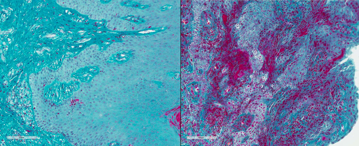 Fibrin staining in human gum tissue