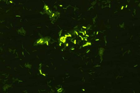 <i>Mycobacterium vaccae</i>