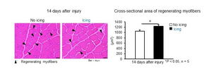図2　軽微な筋損傷2週間後における再生筋線維横断面と横断面積の比較