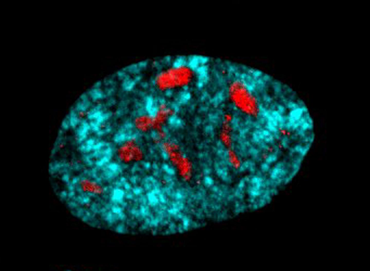 Ribosomal DNA in Prematurely Senescing Cells