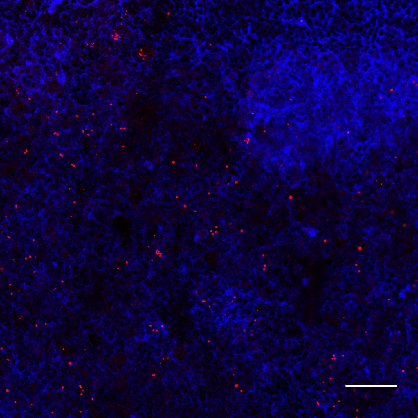 Lymph Nodes Infected with <i>Salmonella</i>