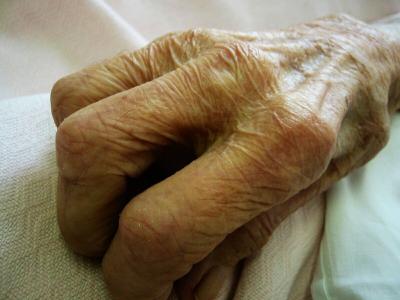 Melatonin and Exercise Work against Alzheimer's in Mice