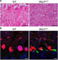 Accumulation of iron and ceruloplasmin in neuron-specific Wipi3cKO mice