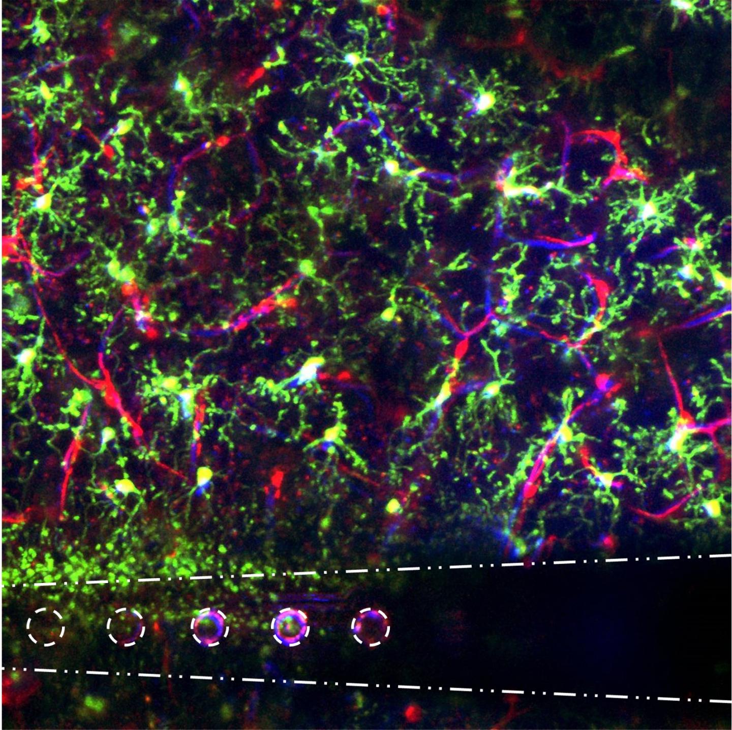 Electrical Stimulation in the Brain