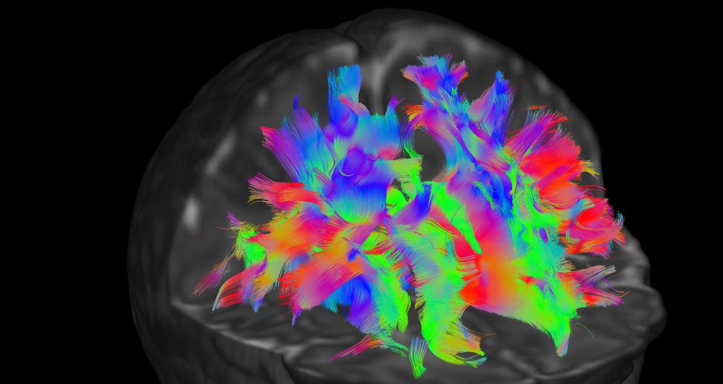 Scan of Newborn Baby's Brain