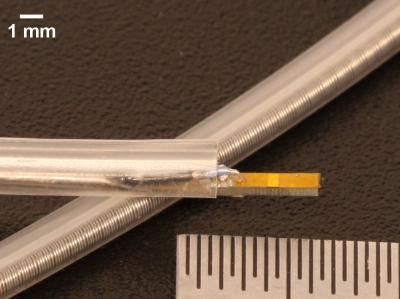 Ultrasound Device Identifies High-Risk Arterial Plaque