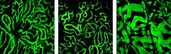 Thyrotropin Affects the Vascular Diameter of Capillaries Surrounding the Thyroid