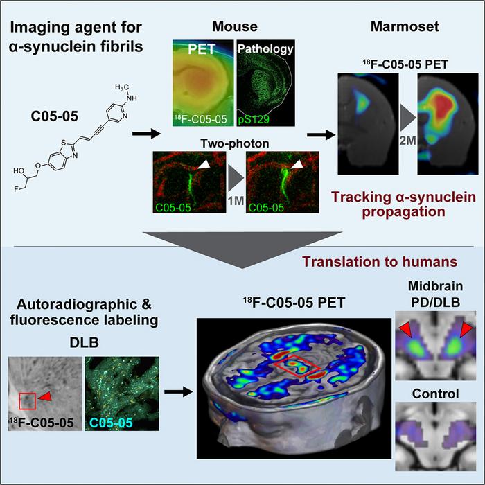 Multi-scale imaging of harmful protein aggregates in live patients with PD and DLB.
