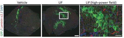 Representative Immunohistochemistry of GFP-Positive Fibers in Transplanted Muscles