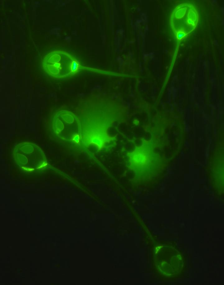 Fluorescence micrograph of spores of the parasitic cnidarian Henneguya salminicola.