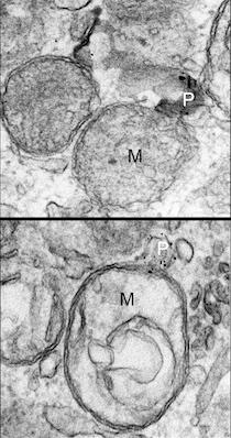 Mitochondrial Autophagy
