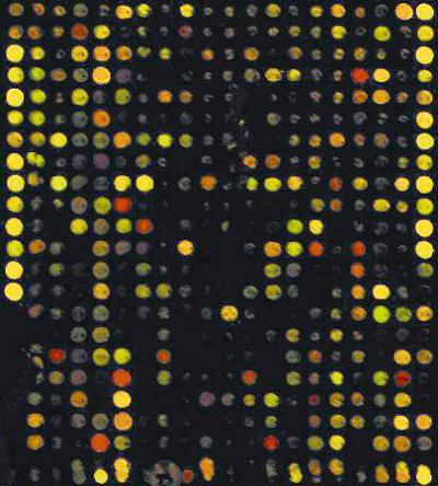 Chipping Away at Parkinson's