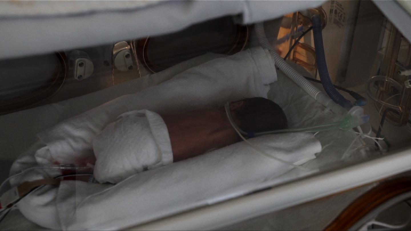Blocking Light Improves Preemies' Survival Rates (3 of 3)