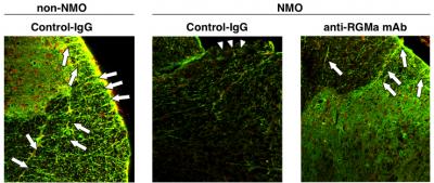 Fig.2 Anti-RGMa mAb Partially Restored AQP4 and GFAP Expression