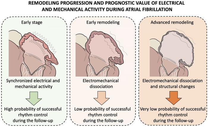 Schematic representation of the progression of electromechanical remodeling of the heart atria during atrial fibrillation, indicating at each disease stage the probability of restoring normal rhythm after an uninterrupted atrial fibrillation episode