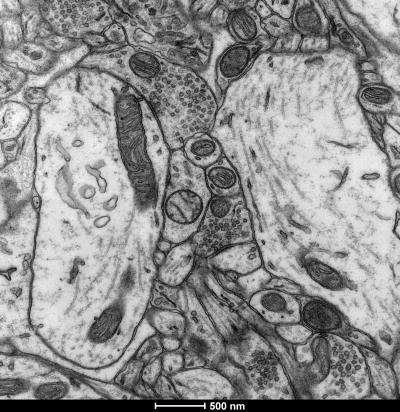 Mitochondria In The Nucleus Accumbens