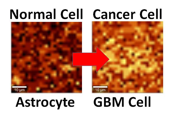 Normal and Cancerous Brain Cells Interfaced with Graphene