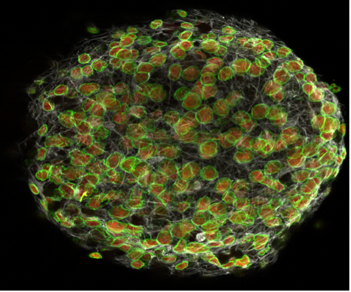 A small group of neural stem cells isolated from mice and cultured in vitro observed under a confocal microscope.