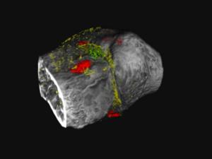 novel contrast agents that target two proteins implicated in osteoarthritis