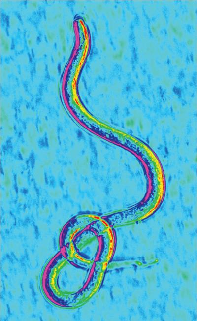 Unraveling the Elephantiasis Worm Genome (3 of 4)