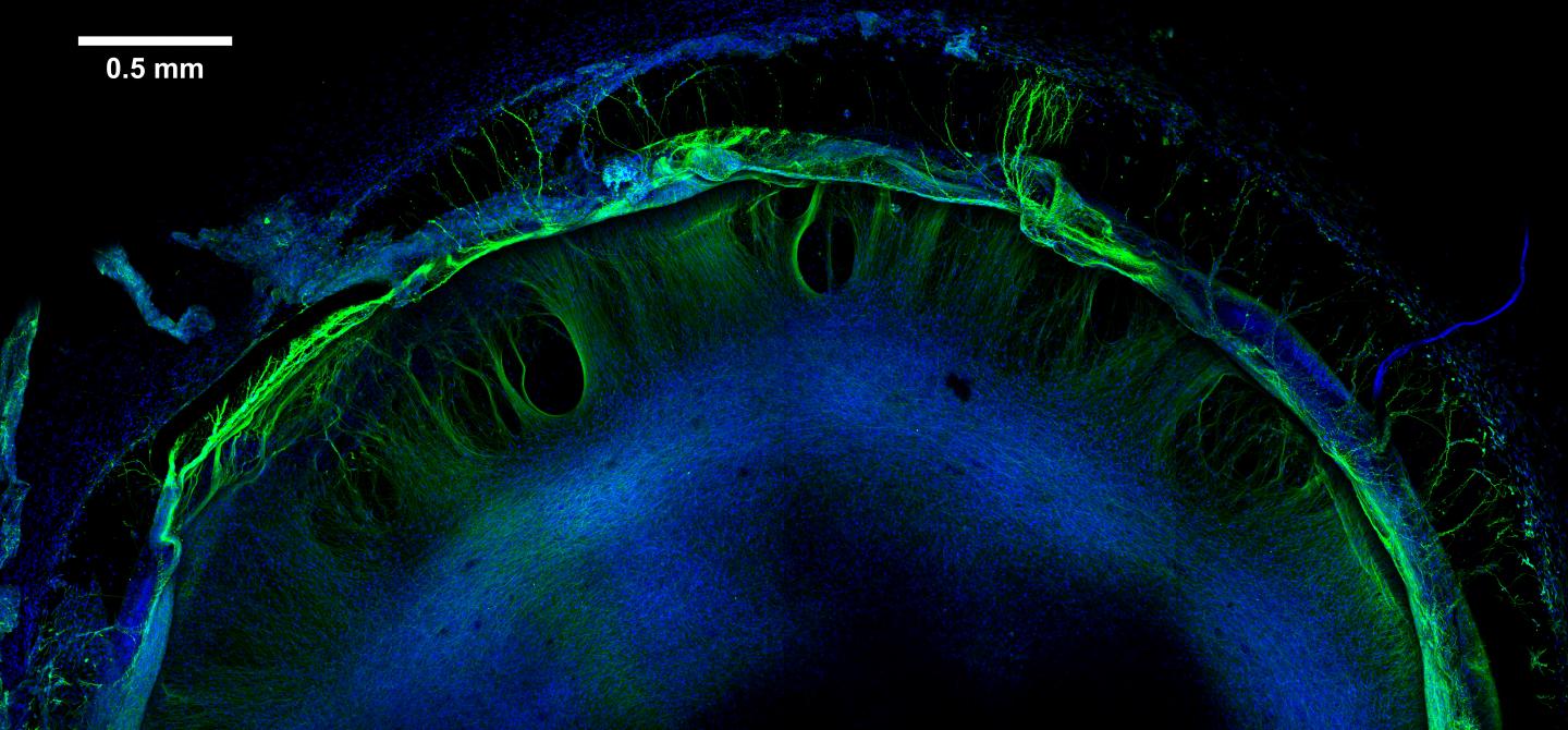 Neural Tissue Formation
