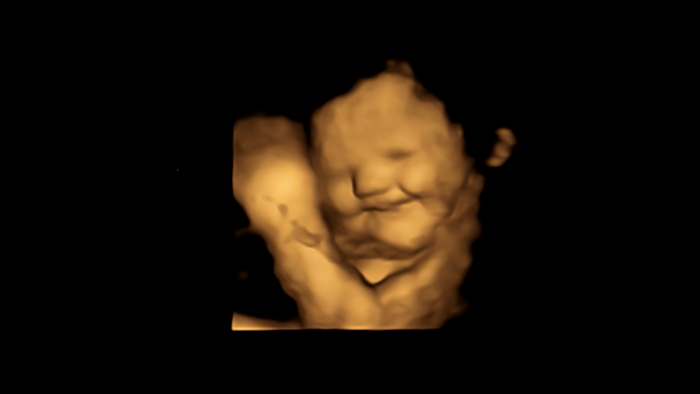 Laughter-face reaction scan image