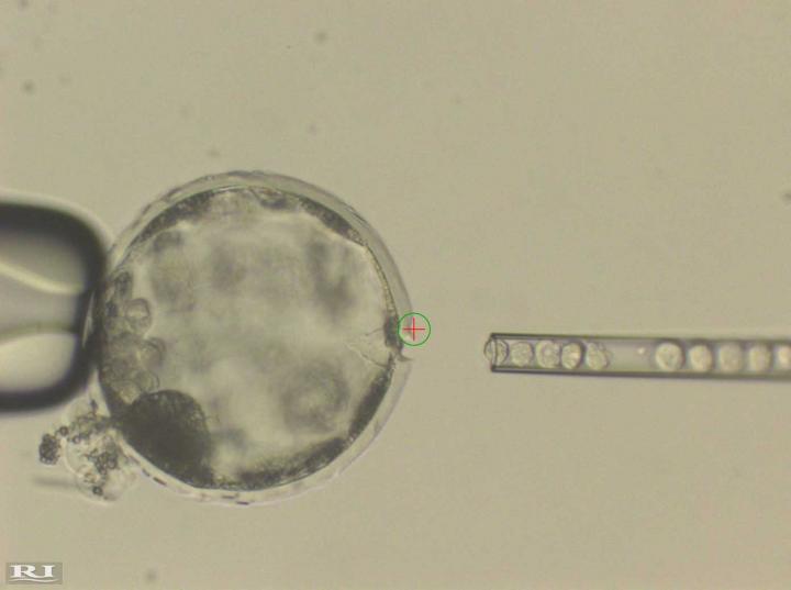 Human iPS Cells in a Pig Blostocyst