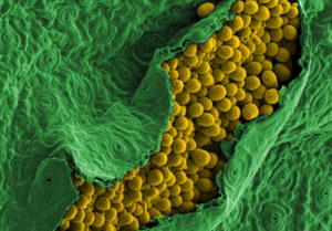 Scanning electron microscope image of myrtle rust.