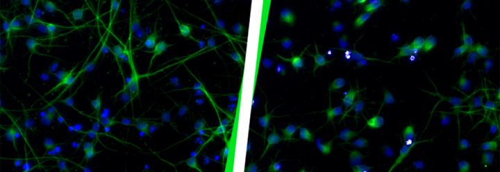 Healthy neurons (left) compared to neurons after HERV-K(HML-2) activation (right).