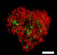 A microbial ANME consortium
