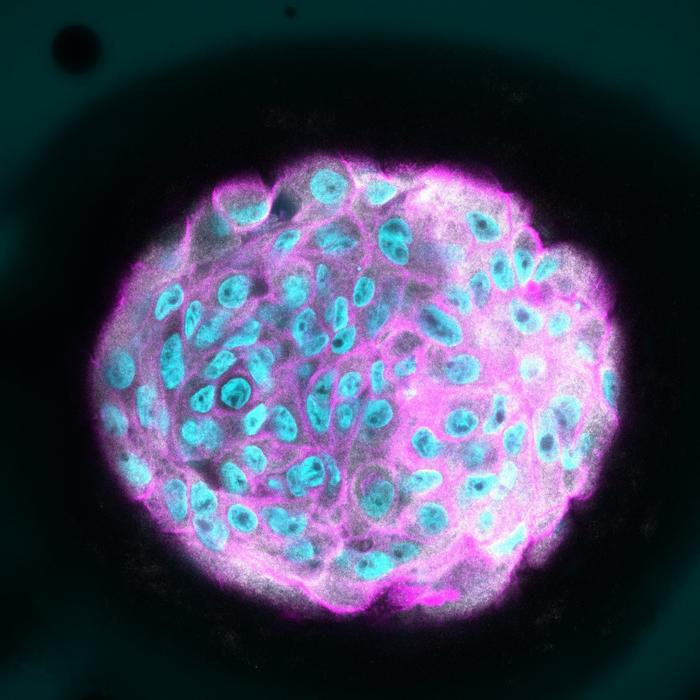 Breast cells acting non-invasively due to the presence of laminin.