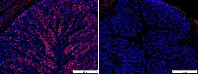 Suppressing T Cell Function in Colitis