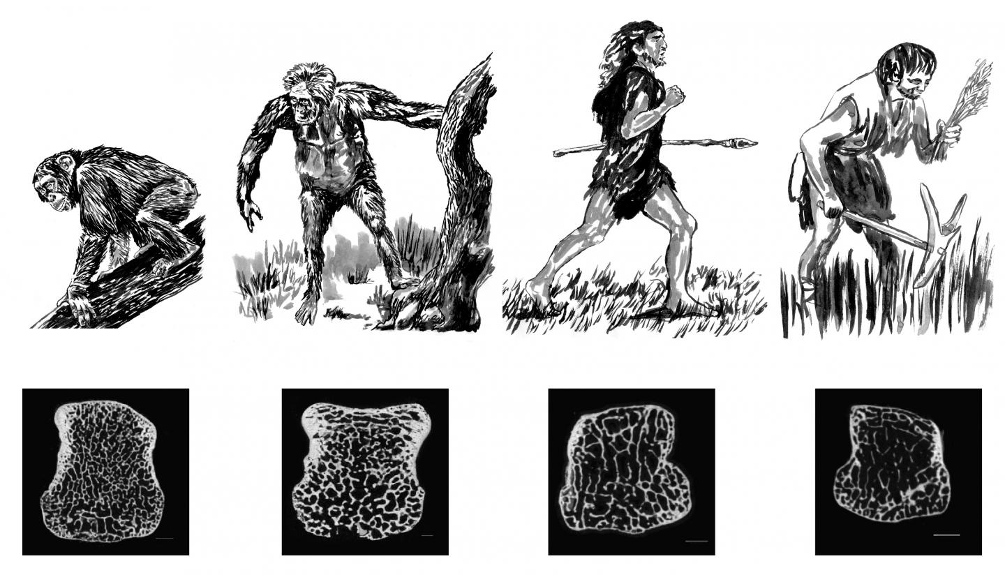 Bone Density Illustration