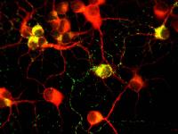 Frataxin Protein in Neurons