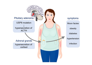 Figure 1. Signs and symptoms of Cushing’s disease