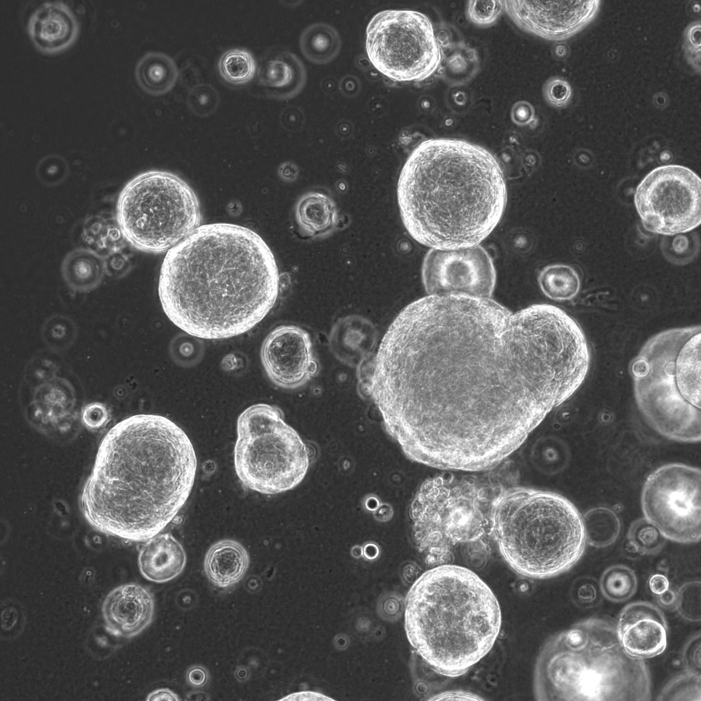 Patient-Derived Organoids Help Predict How Patients Respond to Chemotherapy (5 of 5)