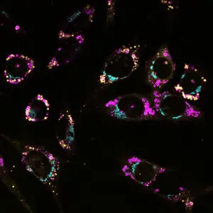 APOE Accumulating Around Lipid Droplets