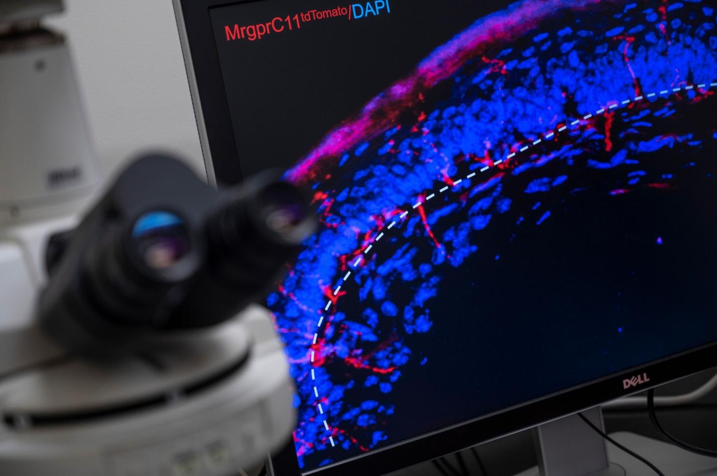 Glabrous skin sensory nerves labeled