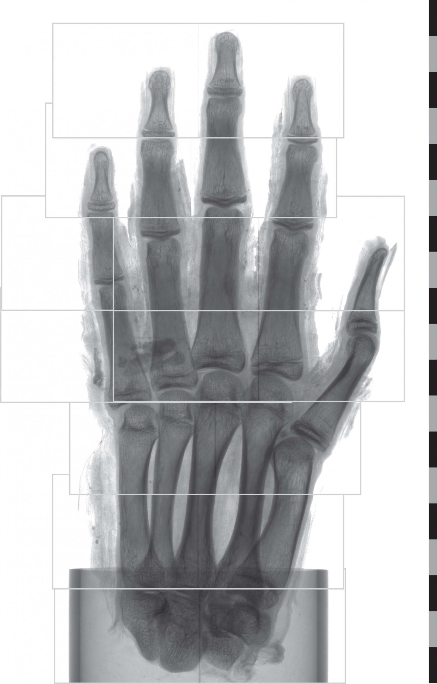 Regions for Tomographic Scans in Mummy Hand