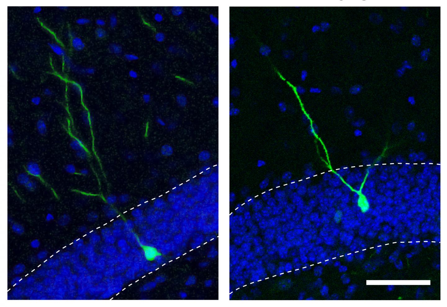 Small Molecule Keeps New Adult Neurons from Straying, May Be Tied to Schizophrenia