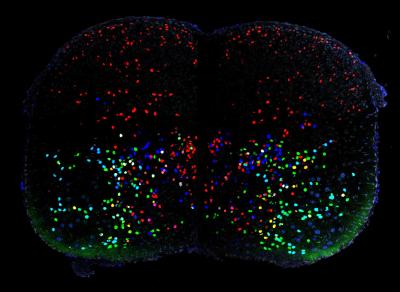 Molecular Diversity of V1 Interneurons