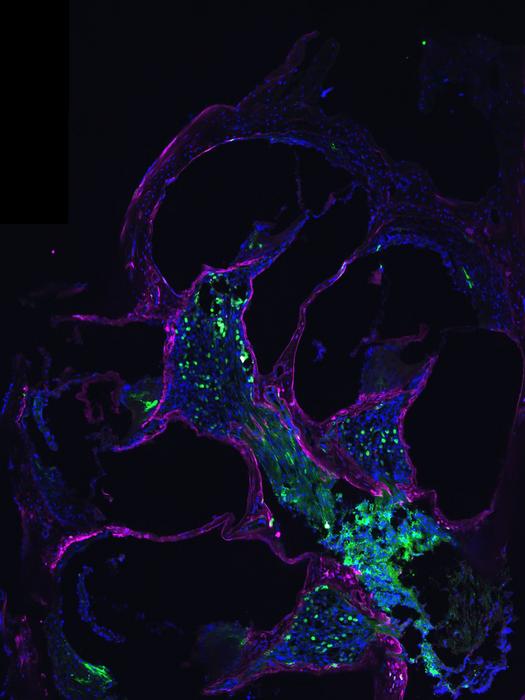 A slice through a cochlea after gene therapy (green)  shows replaced norrin protein in pink / magenta.