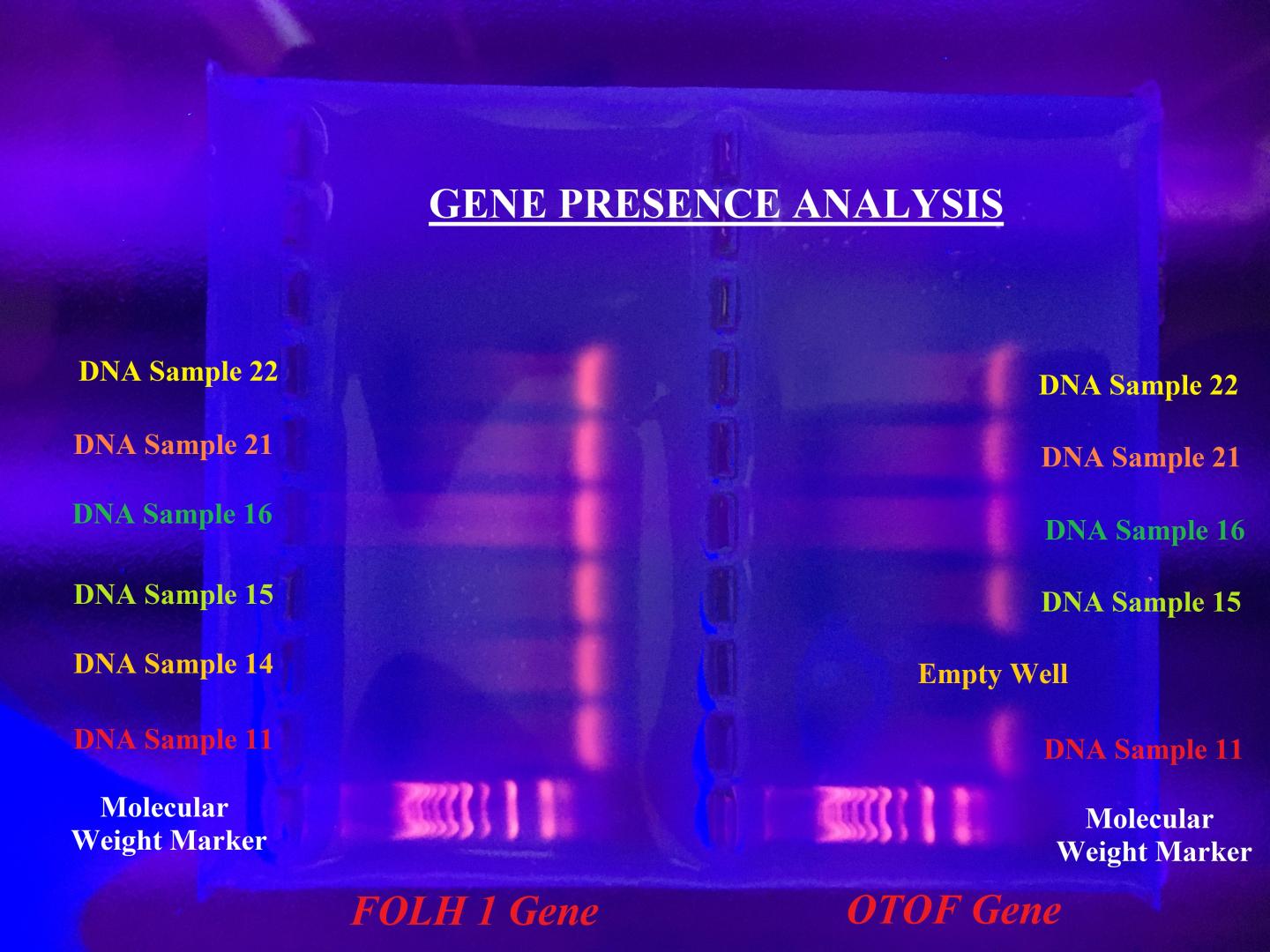 DNA bands