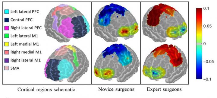 Cutting-Edge Brain Imaging Method Accurately Evaluates Surgeon Skill Levels (3 of 3)