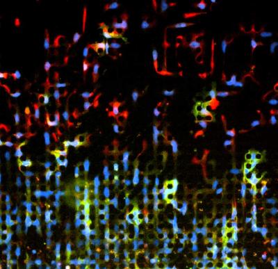 Imaging Cancer Cell Invasion (1 of 2)