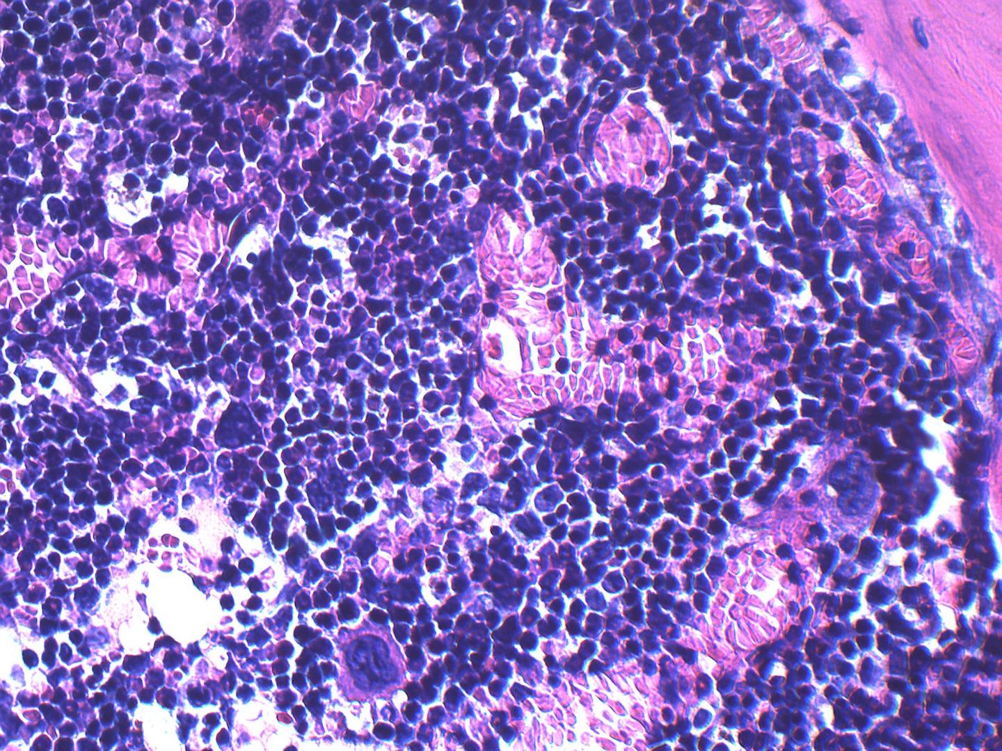 Obesity and Bone Marrow