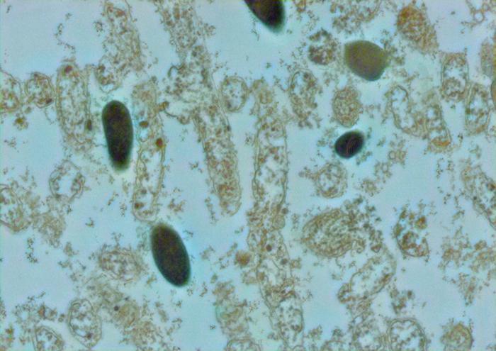 Lactobacillus iners